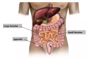 best hospital for appendix surgery in Narsinghpur, best doctor for appendix treatment in Narsinghpur, cost of appendix surgery in Narsinghpur