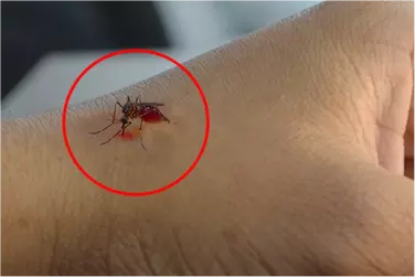 best hospital for dengue treatment in narsinghpur, best doctor for dengue treatment in narsinghpur, cost of dengue treatment in narsinghpurniya.webp