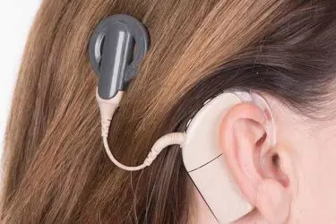 best hospital for cochlear implant surgery in narsinghpur, best doctor for cochlear implant surgery in narsinghpur, cost of cochlear implant surgery in narsinghpur