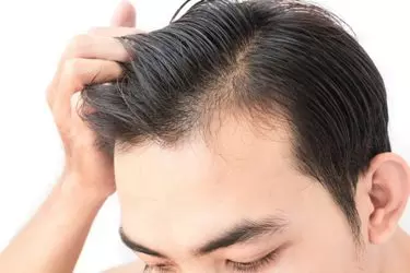 best hospital for hair transplant in Narsinghpur, best doctor for hair transplant in Narsinghpur, cost of hair transplant in Narsinghpur